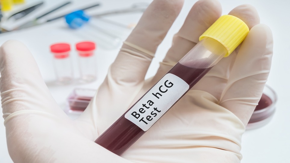 آزمایش‌ خون برای تشخیص بارداری ناخواسته